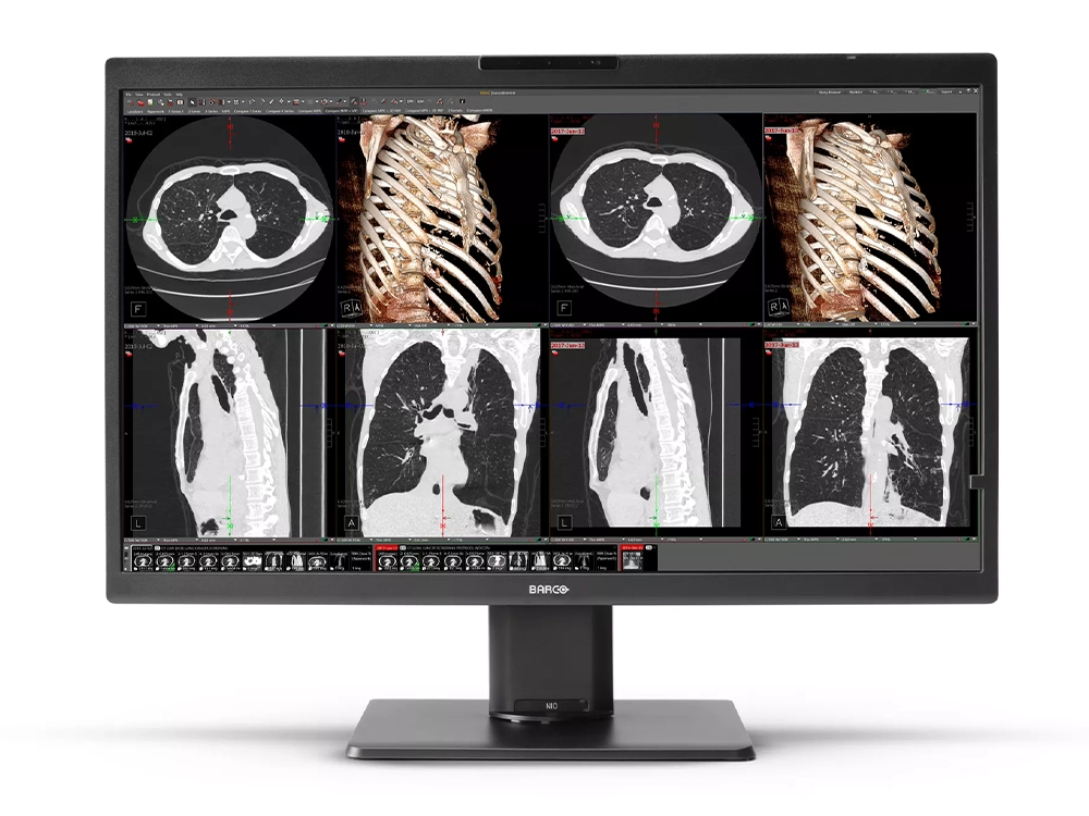 Monitor para radiologia Barco.